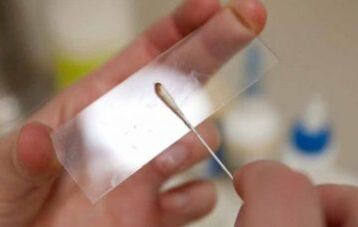 Quali test dovrebbero essere effettuati per i parassiti
