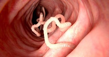 Le cause dei parassiti nel corpo umano
