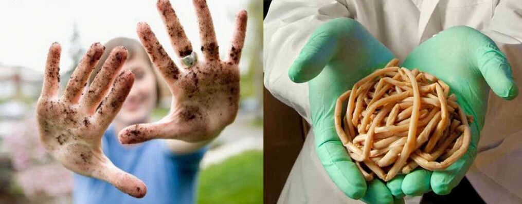 I parassiti possono entrare nel corpo attraverso le mani sporche