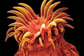 Parassiti trematodi nell'uomo