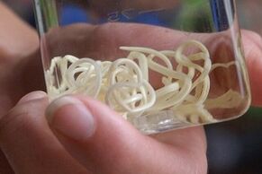 parassiti dal corpo umano